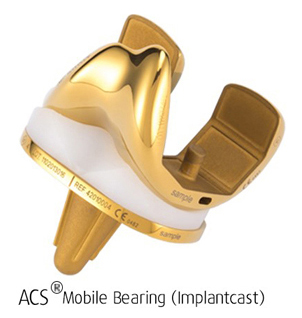 ACS Mobile Bearing (Implantcast)