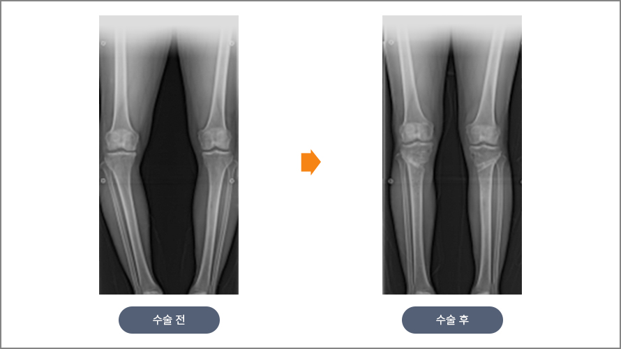 수술 전후